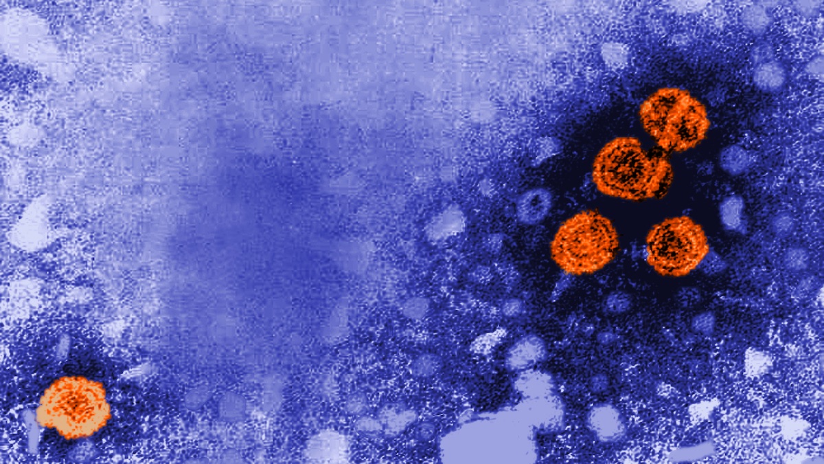 Des particules virales de l'hépatite B sont colorées en orange sur cette photographie en microscopie à transmission /CDC/ Dr. Erskine Palmer